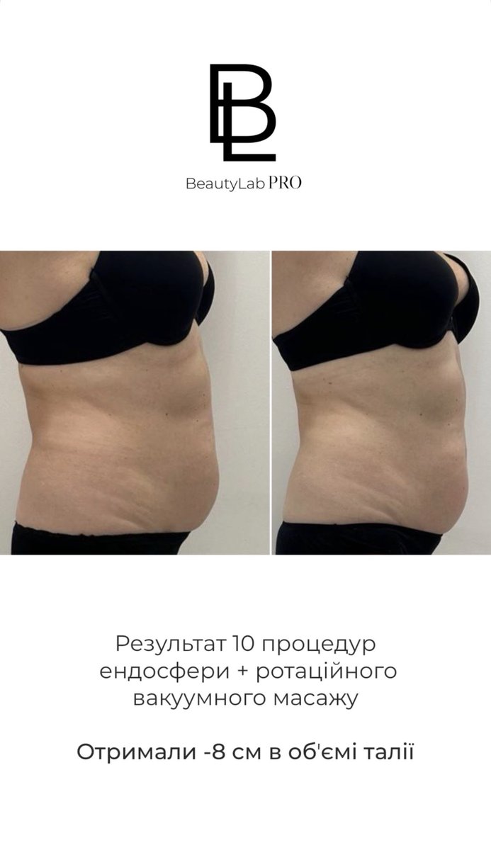 Результат корекції фігури до і після